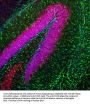 Anti-Glial Fibrillary Acidic Protein (GFAP) Antibody