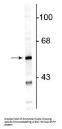 Anti-Glial Fibrillary Acidic Protein (GFAP) Antibody
