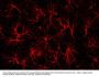 Anti-Glial Fibrillary Acidic Protein (GFAP) Antibody