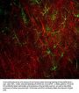 Anti-Glial Fibrillary Acidic Protein (GFAP) Antibody