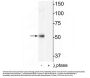 Anti-HDAC2 (Ser394) Antibody