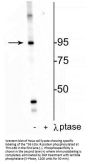 Anti-Insulin Receptor (Thr1160) Antibody