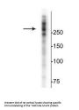 Anti-Microtubule Associated Protein 2 (MAP2) Antibody