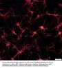 Anti-Microtubule Associated Protein 2 (MAP2) Antibody