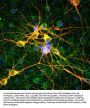 Anti-Microtubule Associated Protein 2 (MAP2) Antibody