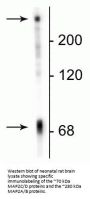 Anti-Microtubule Associated Protein 2 C/D (MAP2C/D) Antibody