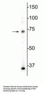 Anti-MeCP2 Antibody