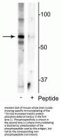 Anti-MeCP2 (Ser421) Antibody