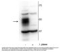 Anti-MEF2C (Ser222) Antibody