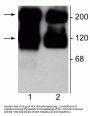 Anti-Metabotropic Glutamate Receptor 5/1a Antibody