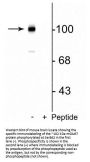 Anti-Metabotropic Glutamate Receptor 7 (Ser862) Antibody