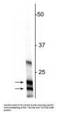 Anti-Myelin Basic Protein (MBP) Antibody