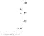 Anti-Olig1 Antibody