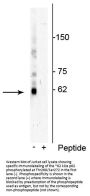 Anti-p62 (Thr269, Ser272) Antibody