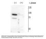 Anti-PanK4 (Thr63) Antibody