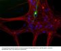 Anti-Peripherin Antibody