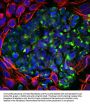 Anti-Peripherin Antibody