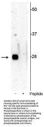 Anti-Ribosomal protein S6 (Ser244) Antibody