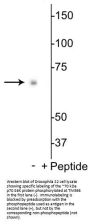 Anti-p70 S6 Kinase (Ser398) Antibody