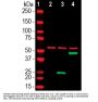 Anti-SARS-CoV-2 S-Protein ACE2 Binding Domain Antibody
