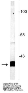 Anti-SNAP25 Antibody