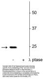 Anti-SNAP25 (Ser187) Antibody