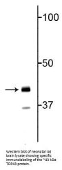 Anti-TDP43 Antibody