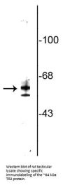 Anti-Testicular Receptor 2 (TR2) Antibody