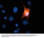 Anti-TREM2 Antibody