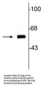 Anti-Tyrosine Hydroxylase Antibody