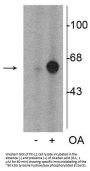 Anti-Tyrosine Hydroxylase (Ser31) Antibody