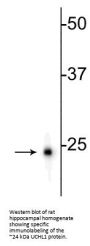 Anti-Ubiquitin C-terminal Hydrolase 1 (UCHL1) Antibody