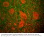 Anti-Ubiquitin C-terminal Hydrolase 1 (UCHL1) Antibody