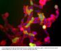 Anti-Ubiquitin C-terminal Hydrolase 1 (UCHL1) Antibody