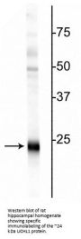 Anti-Ubiquitin C-terminal Hydrolase 1 (UCHL1) Antibody