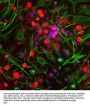 Anti-Ubiquitin C-terminal Hydrolase 1 (UCHL1) Antibody