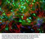 Anti-Ubiquitin C-terminal Hydrolase 1 (UCHL1) Antibody