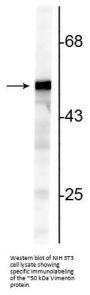 Anti-Vimentin Antibody