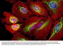 Anti-Vimentin Antibody