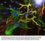 Anti-Vimentin Antibody