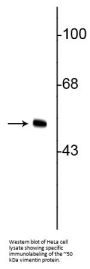 Anti-Vimentin Antibody