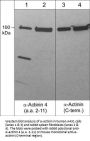 Anti-α-Actinin 4 (N-terminal) Antibody