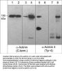 Anti-α-Actinin 4 (Tyr-4), Phosphospecific Antibody