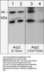 Anti-Arp2 (Thr-237/Thr-238), Phosphospecific Antibody