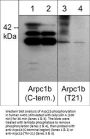 Anti-Arpc1b/p41-Arc (Thr-21), Phosphospecific Antibody