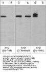 Anti-ATM (Ser-794), Phosphospecific Antibody