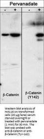 Anti-β-Catenin (Tyr-142) [γ-Catenin (Tyr-133)], Phosphospecific Antibody