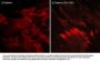 Anti-β-Catenin (Tyr-142) [γ-Catenin (Tyr-133)], Phosphospecific Antibody