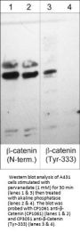 Anti-β-Catenin (Tyr-333) [γ-Catenin (Tyr-324)], Phosphospecific Antibody