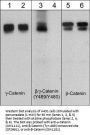 Anti-β-Catenin (Tyr-489) [γ-Catenin (Tyr-480)], Phosphospecific Antibody